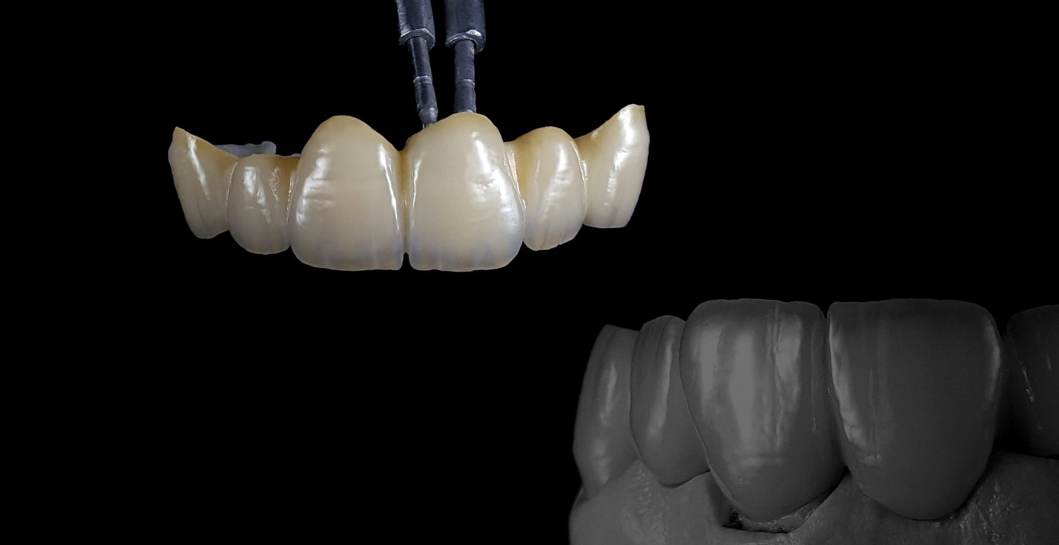 Dentaltechnik Leipzig